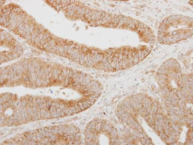 SERPINA12 Antibody in Immunohistochemistry (Paraffin) (IHC (P))