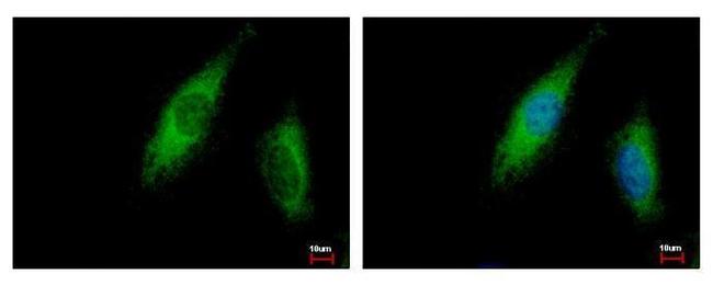 ABCE1 Antibody in Immunocytochemistry (ICC/IF)