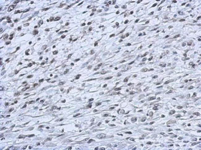 CBX2 Antibody in Immunohistochemistry (Paraffin) (IHC (P))