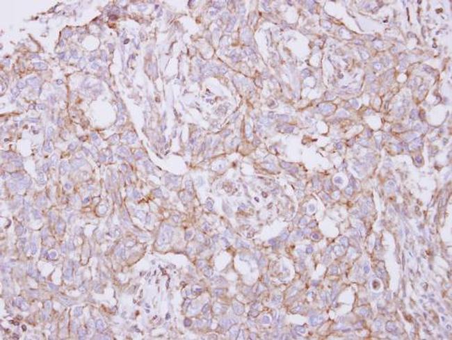 TXNDC9 Antibody in Immunohistochemistry (Paraffin) (IHC (P))