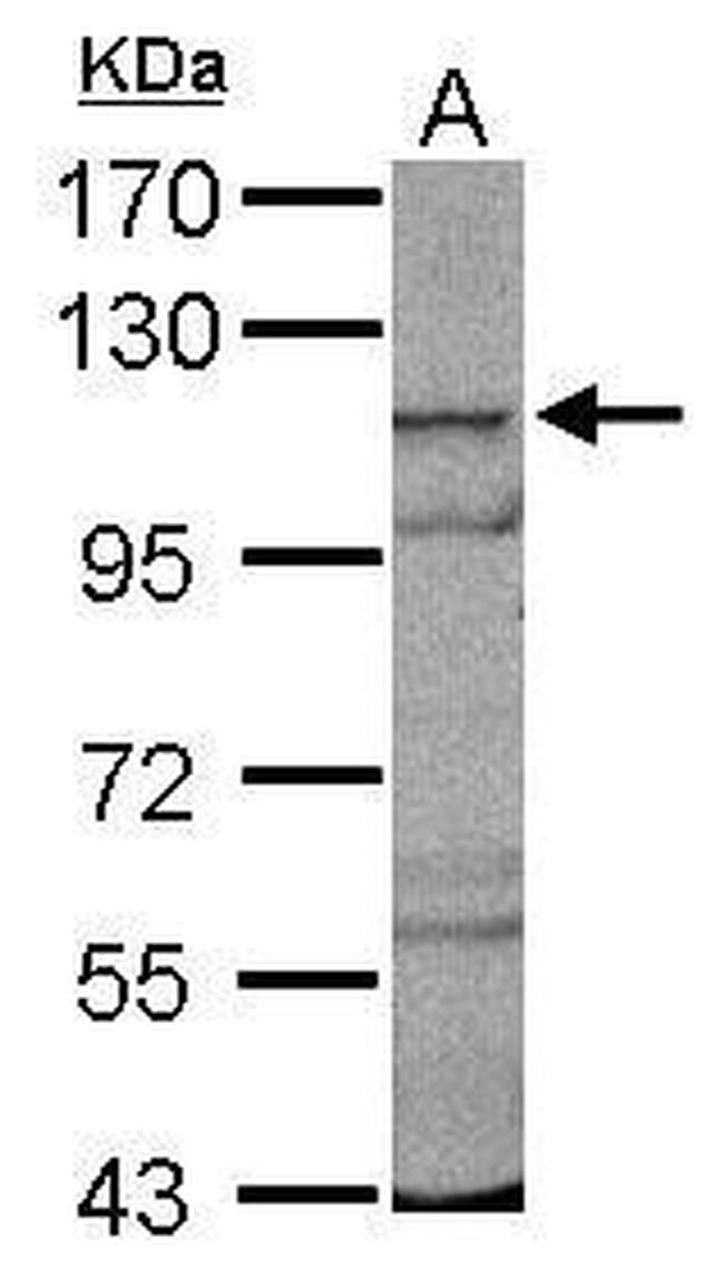 CPSF2 Antibody in Western Blot (WB)