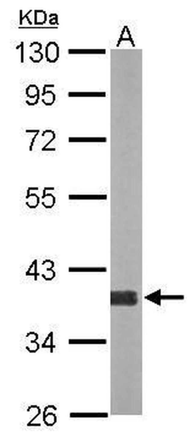 AKR1D1 Antibody in Western Blot (WB)