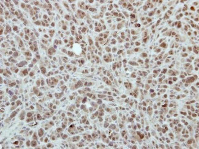 RPP30 Antibody in Immunohistochemistry (Paraffin) (IHC (P))