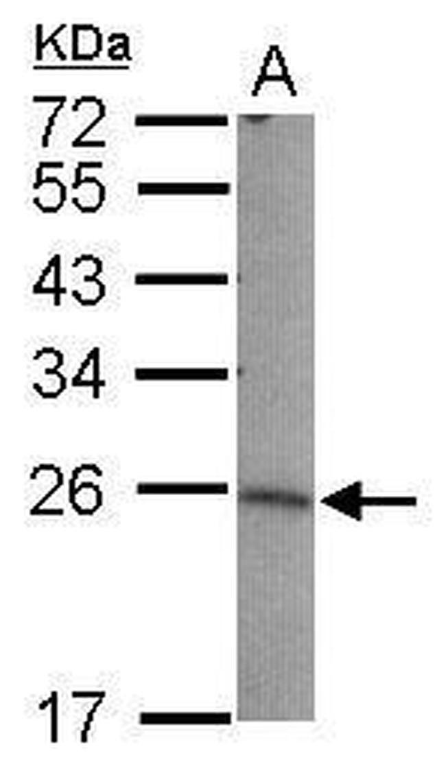 LIN7B Antibody in Western Blot (WB)