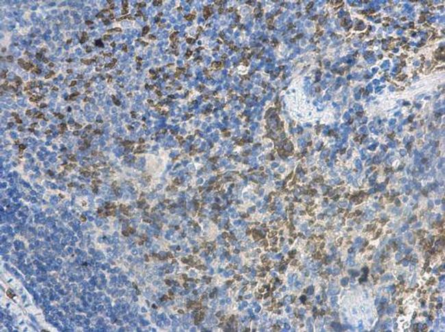 MCTS1 Antibody in Immunohistochemistry (Paraffin) (IHC (P))