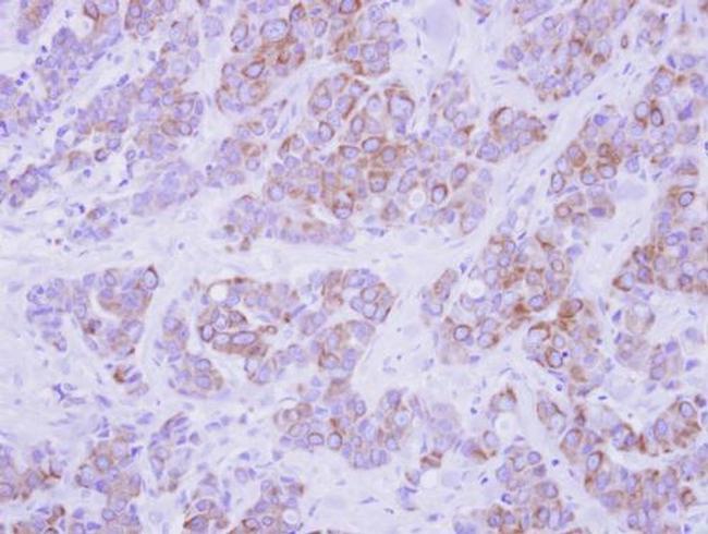 Cytokeratin 2e Antibody in Immunohistochemistry (Paraffin) (IHC (P))