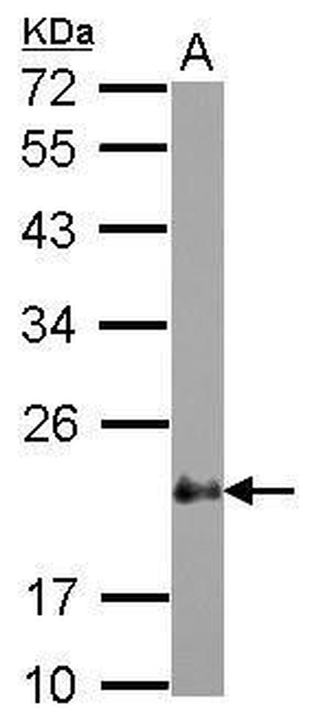 CRP2 Antibody in Western Blot (WB)