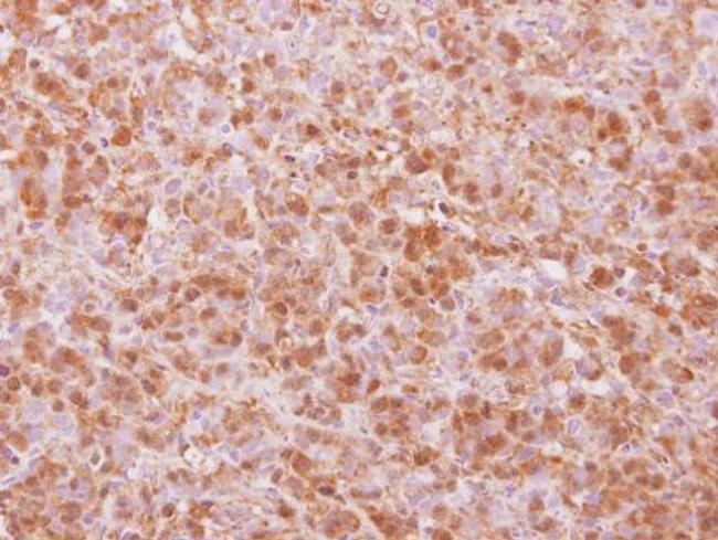 COPS4 Antibody in Immunohistochemistry (Paraffin) (IHC (P))