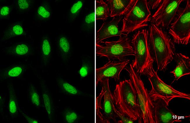 HOXC10 Antibody in Immunocytochemistry (ICC/IF)