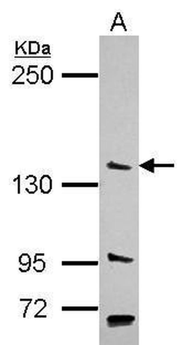 PAN2 Antibody in Western Blot (WB)