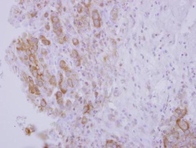 ORP5 Antibody in Immunohistochemistry (Paraffin) (IHC (P))