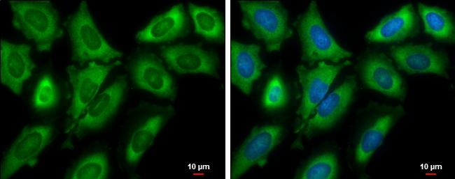 eIF4G3 Antibody in Immunocytochemistry (ICC/IF)