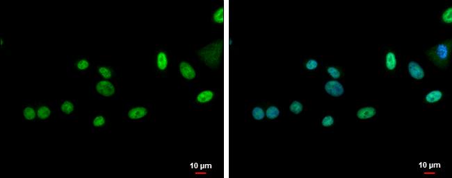 ZNF181 Antibody in Immunocytochemistry (ICC/IF)