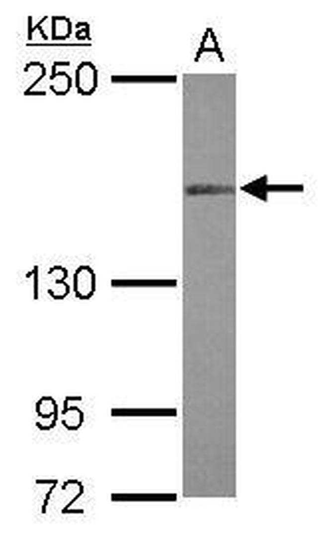 MLH3 Antibody in Western Blot (WB)