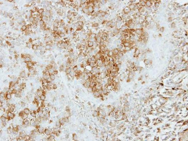 COPS4 Antibody in Immunohistochemistry (Paraffin) (IHC (P))