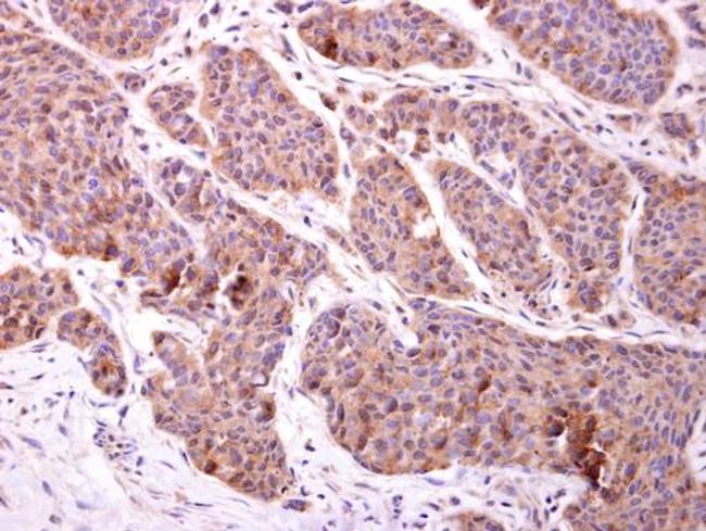 CHMP2B Antibody in Immunohistochemistry (Paraffin) (IHC (P))