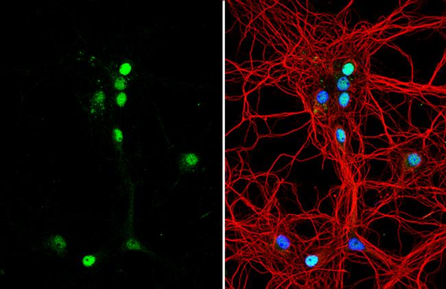 Tenascin R Antibody in Immunocytochemistry (ICC/IF)