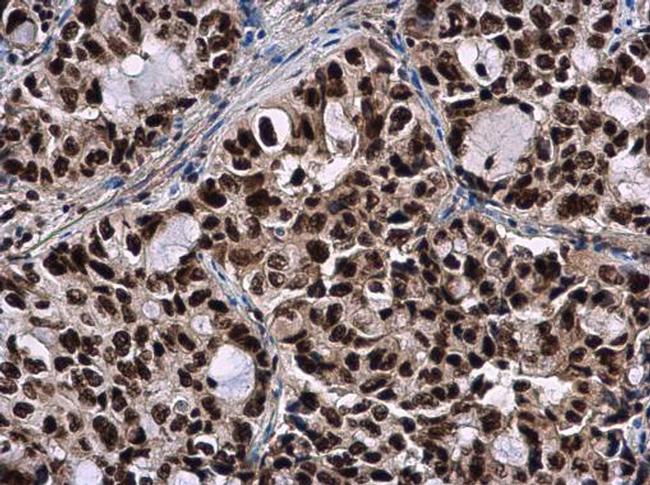 SMNDC1 Antibody in Immunohistochemistry (Paraffin) (IHC (P))