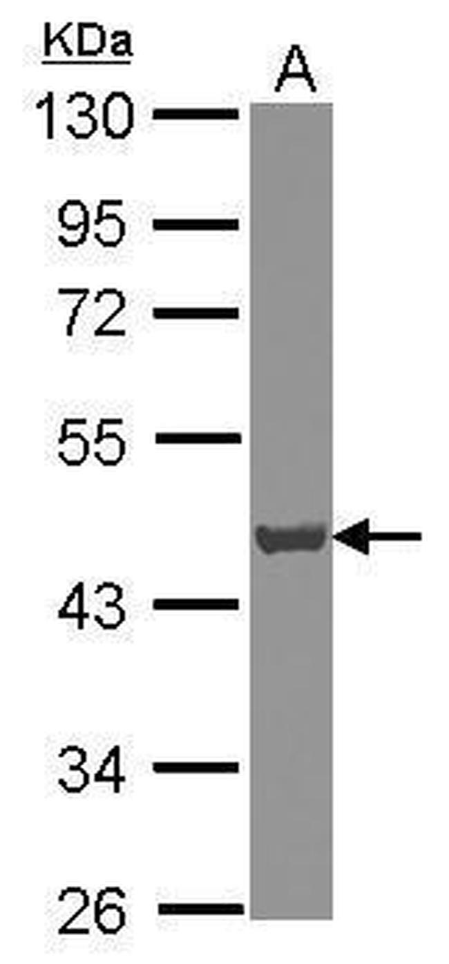 ATP6V0D1 Antibody in Western Blot (WB)