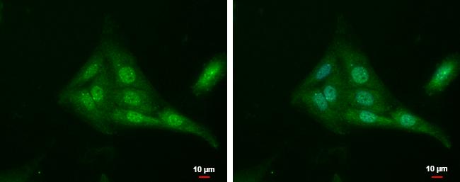 TUB Antibody in Immunocytochemistry (ICC/IF)