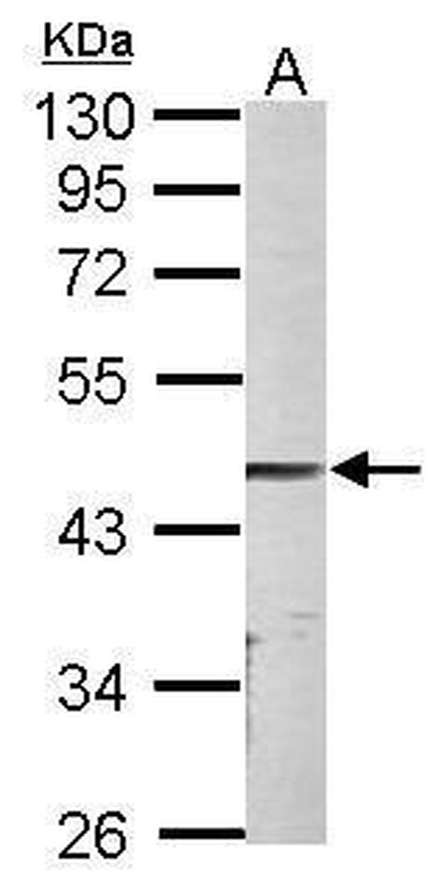 PARVA Antibody in Western Blot (WB)