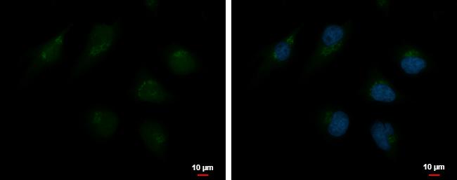 TMF1 Antibody in Immunocytochemistry (ICC/IF)