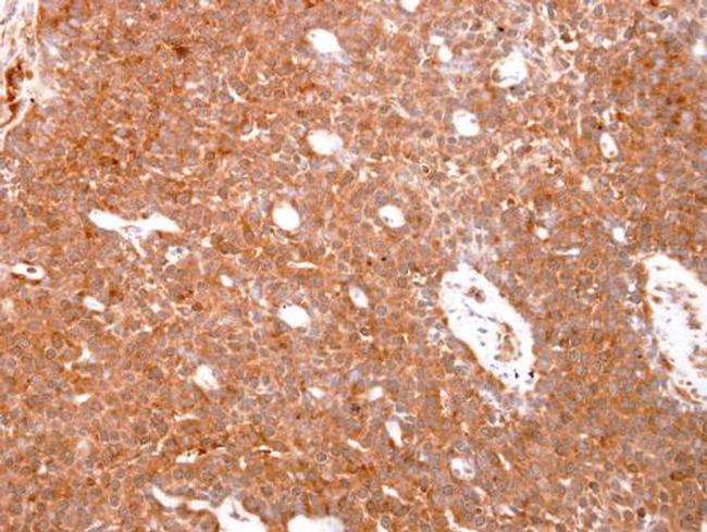 GST Omega 1 140A Antibody in Immunohistochemistry (Paraffin) (IHC (P))