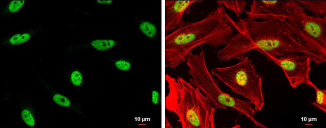 DPPA4 Antibody in Immunocytochemistry (ICC/IF)