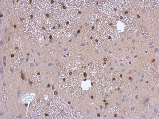 ADI1 Antibody in Immunohistochemistry (Paraffin) (IHC (P))