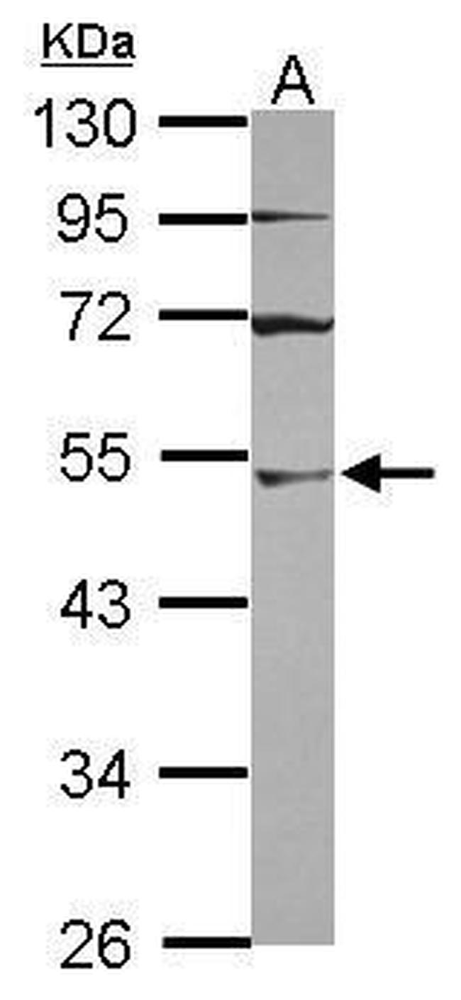 UBA3 Antibody in Western Blot (WB)