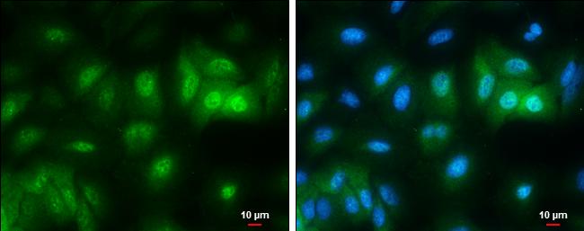 RBPMS Antibody in Immunocytochemistry (ICC/IF)