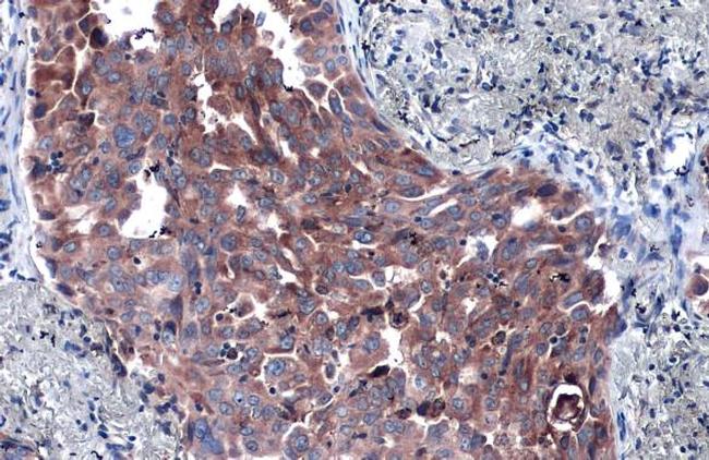 P4HA1 Antibody in Immunohistochemistry (Paraffin) (IHC (P))