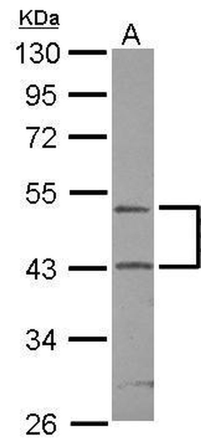 RUNDC3A Antibody in Western Blot (WB)