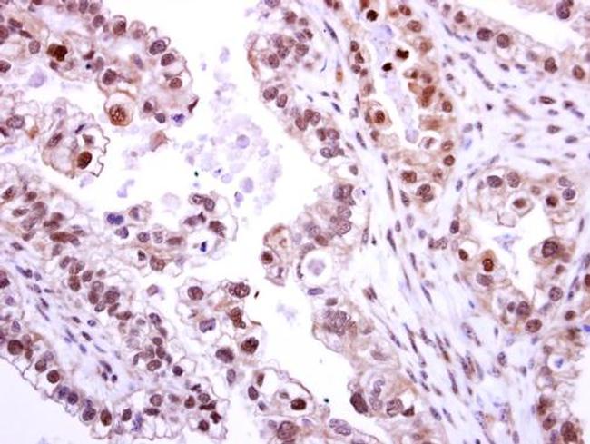 NEK2 Antibody in Immunohistochemistry (Paraffin) (IHC (P))