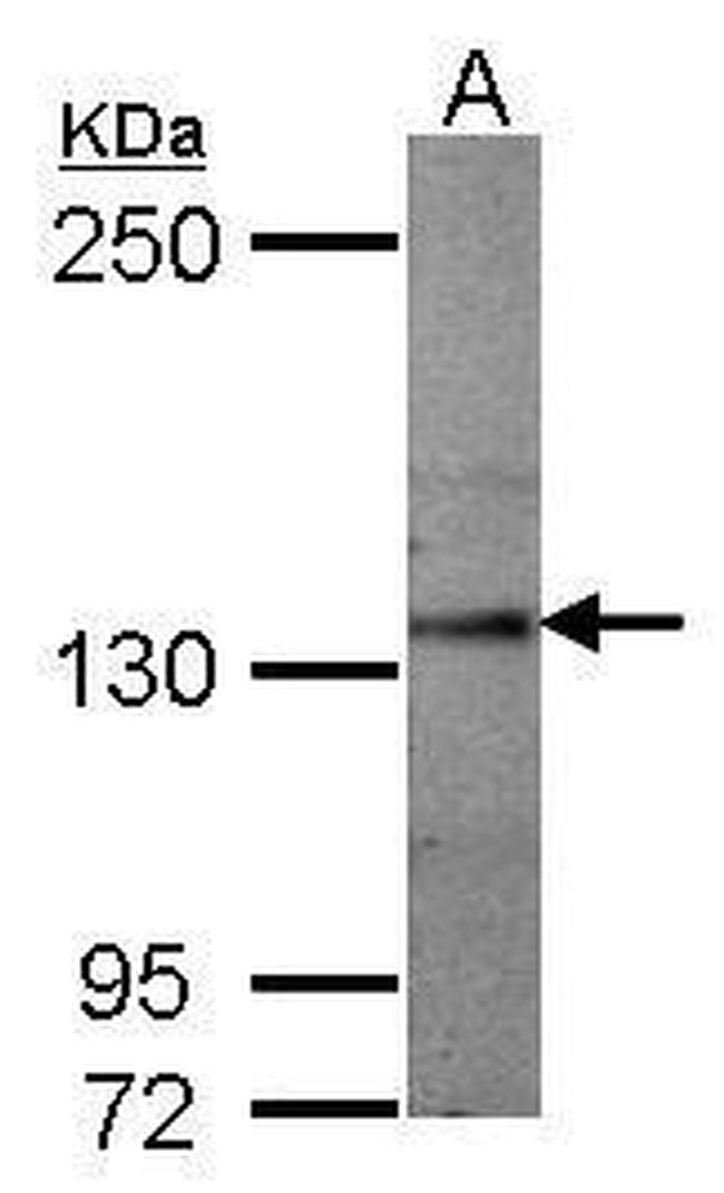 SEMA5A Antibody in Western Blot (WB)