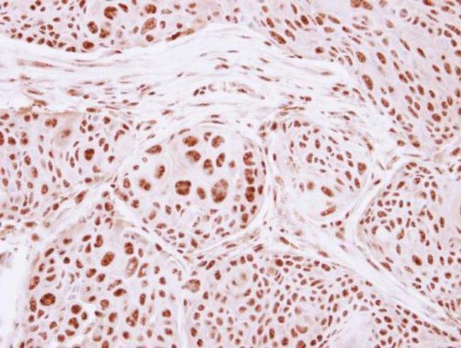 GTF3C4 Antibody in Immunohistochemistry (Paraffin) (IHC (P))