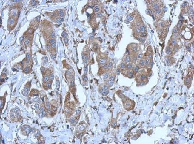 P2X2 Antibody in Immunohistochemistry (Paraffin) (IHC (P))