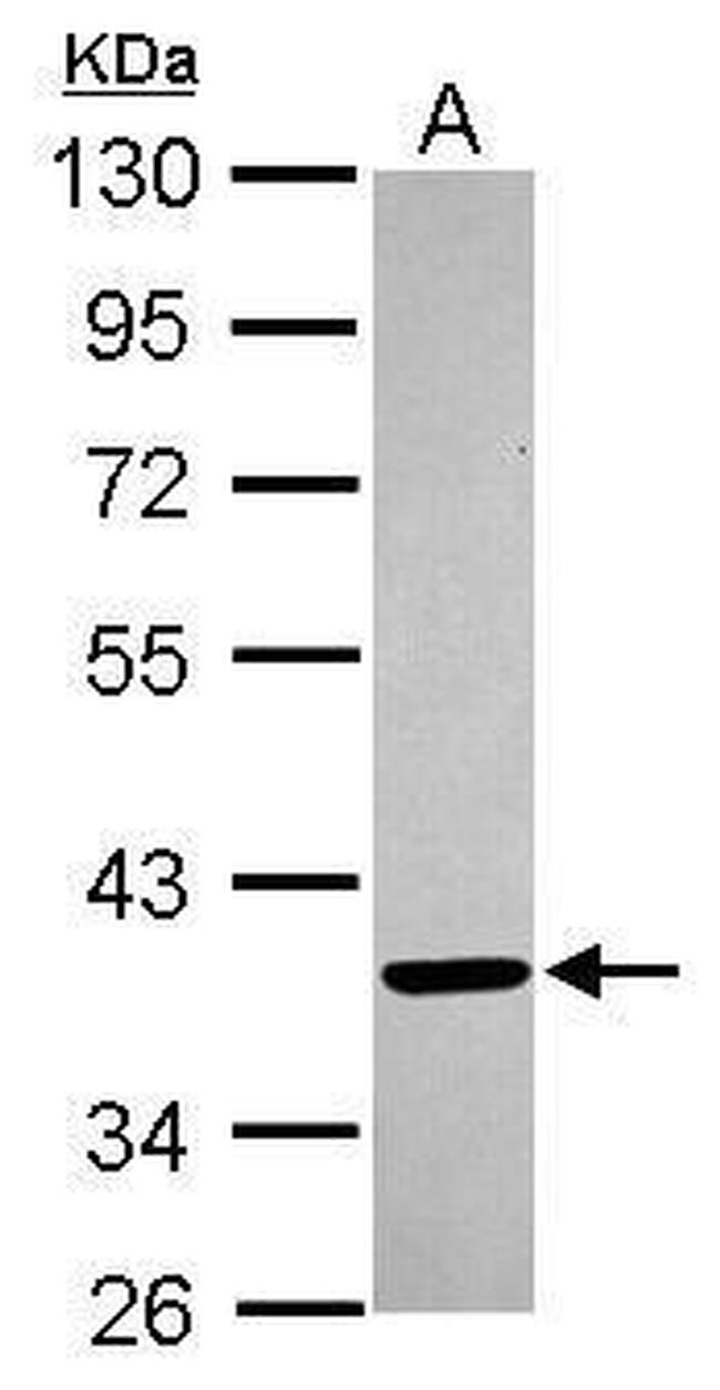 FVT1 Antibody in Western Blot (WB)