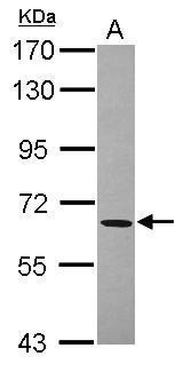 ACOT11 Antibody in Western Blot (WB)