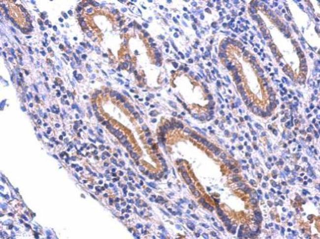 NR1 Antibody in Immunohistochemistry (Paraffin) (IHC (P))