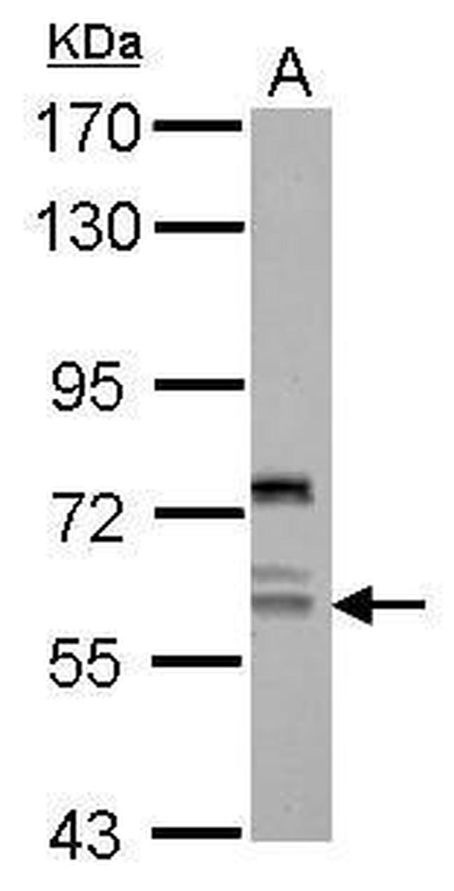 REPIN1 Antibody in Western Blot (WB)