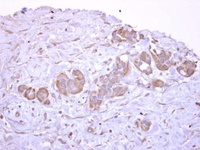 V-ATPase D Antibody in Immunohistochemistry (Paraffin) (IHC (P))