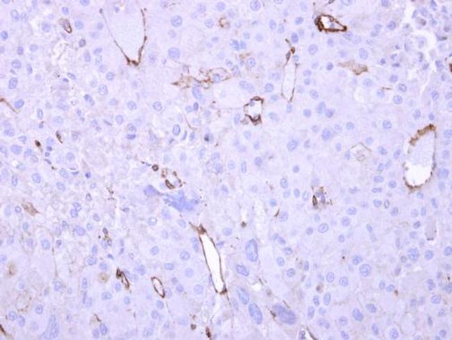 HECA Antibody in Immunohistochemistry (Paraffin) (IHC (P))