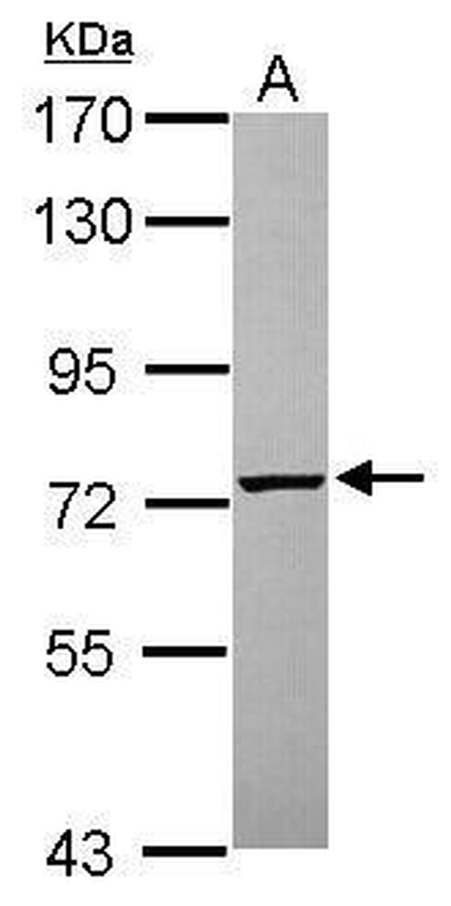 PGM2 Antibody in Western Blot (WB)