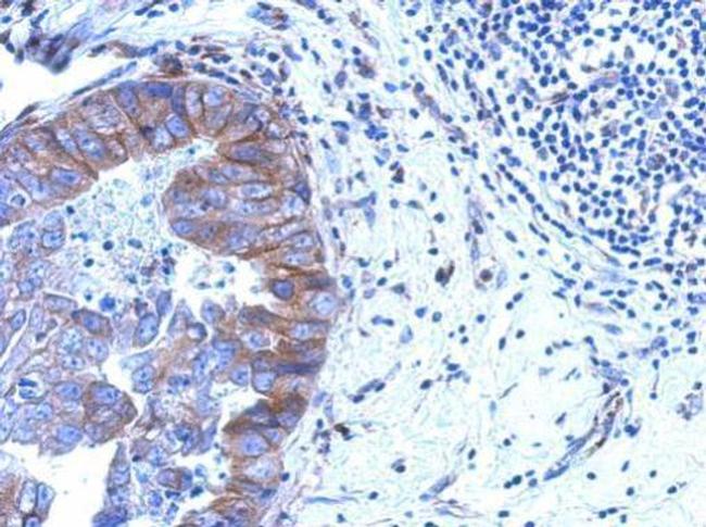 ZNF598 Antibody in Immunohistochemistry (Paraffin) (IHC (P))