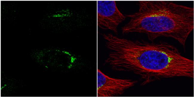 VPS33A Antibody in Immunocytochemistry (ICC/IF)