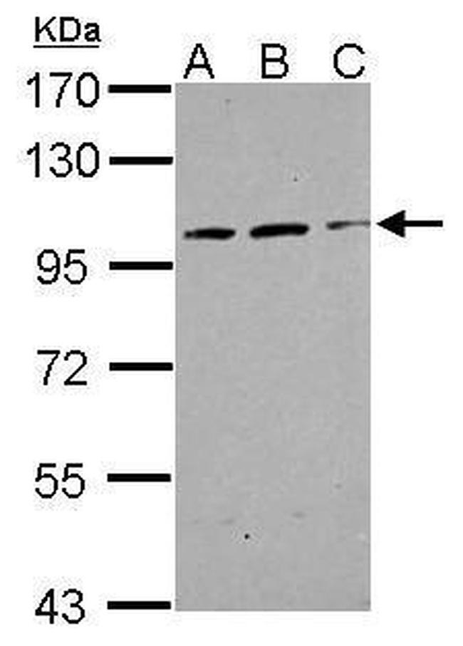 TRAK2 Antibody in Western Blot (WB)