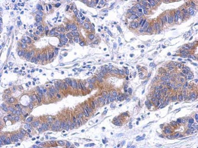 Annexin A8 Antibody in Immunohistochemistry (Paraffin) (IHC (P))