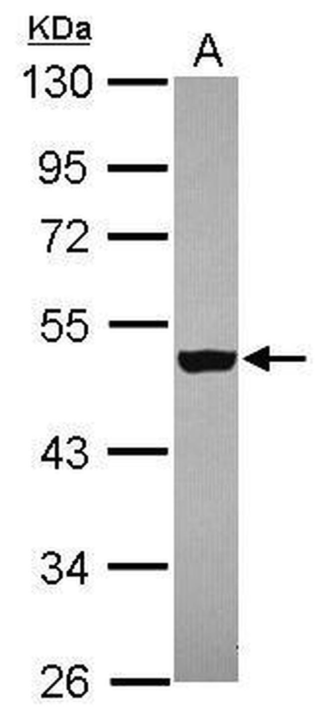 ZNF584 Antibody in Western Blot (WB)