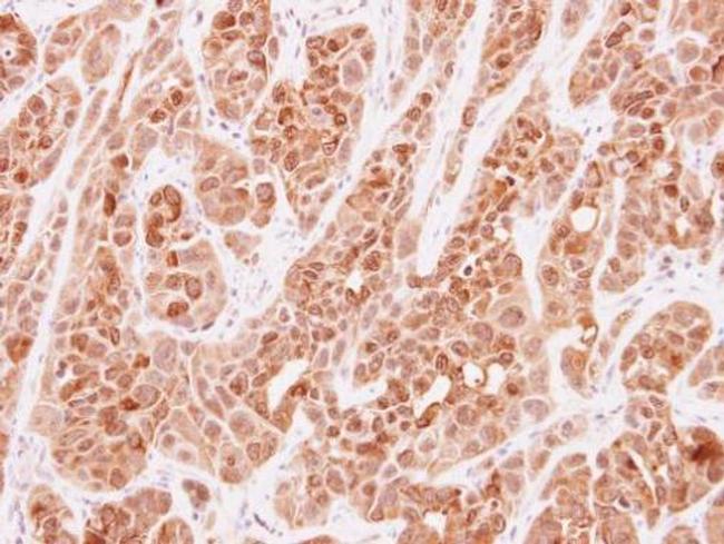 VLK Antibody in Immunohistochemistry (Paraffin) (IHC (P))